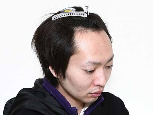 新着デコ 広い 男 髪型 世界のすべての髪型