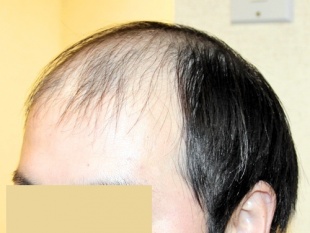 手術前の写真2