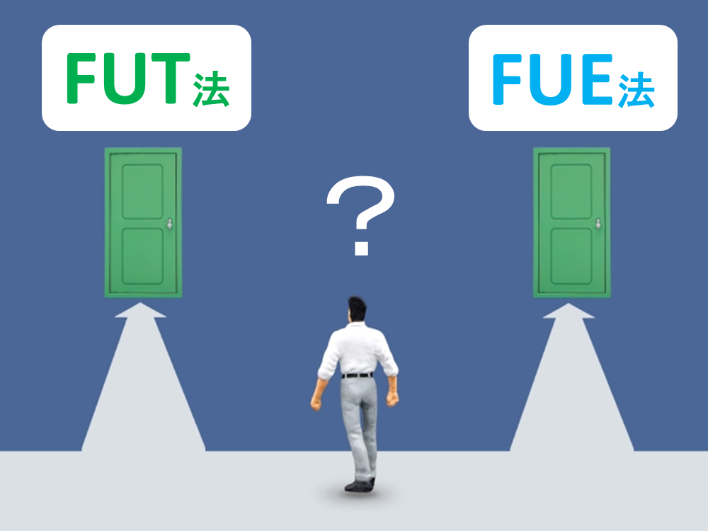 植毛を行うときにFUT法とFUE法のどちらを最初に行うべきか