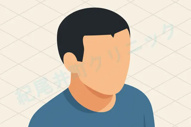 富士額はM字はげになりやすい?