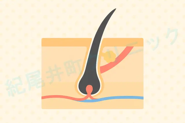 毛包とは？