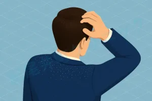 フケと薄毛の関係は？ 原因や予防、対策・治療法を紹介