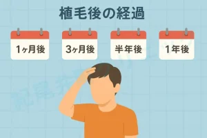 植毛後の経過（1ヶ月後、3ヶ月後、半年後、1年後）【医師監修】