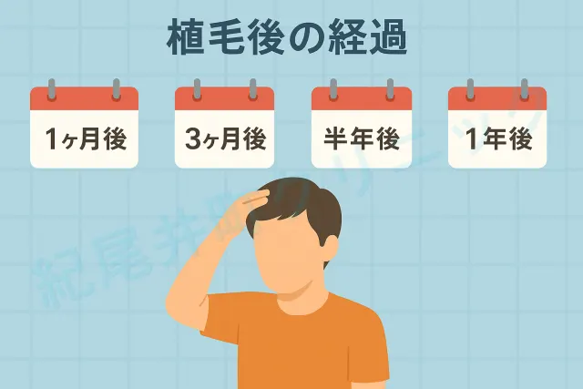 植毛後の経過（1ヶ月後、3ヶ月後、半年後、1年後）【医師監修】
