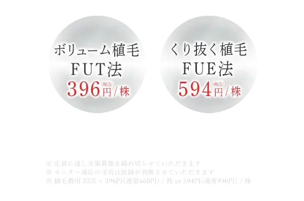 モニタープラン右