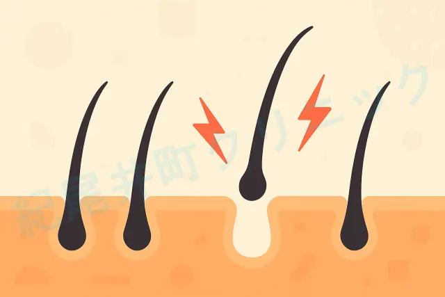 自毛植毛した毛包が定着しない理由は？【医師監修】