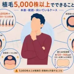 植毛5,000株以上でできることは？広範囲植毛・費用・段階的治療の考え方を解説